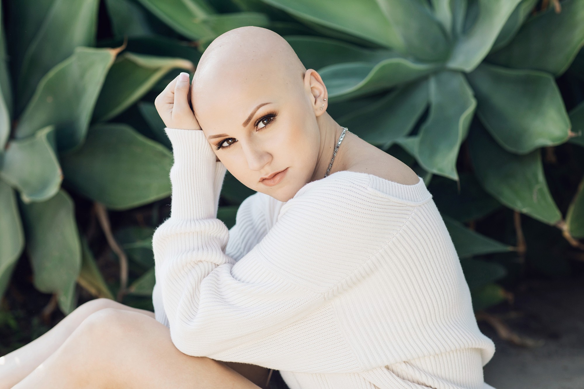 beautiful senior pictures of alopecia girls